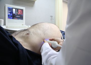La dolencia invisible que afecta a uno de cada tres adultos