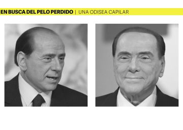 Cómo se diseña un implante de pelo para no acabar como Berlusconi