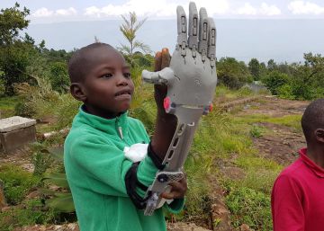 El joven que manda prótesis a África mientras otros juegan al ordenador