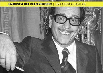 ¿Cuánto cuesta un implante de pelo?