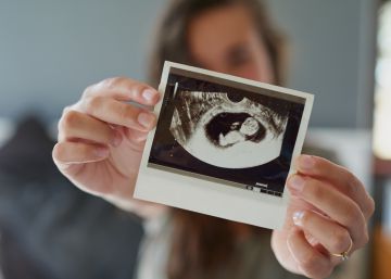 Así nace un niño sin la alteración genética de sus padres
