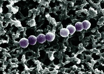 Un antibiótico utilizado en la Unión Soviética es la nueva esperanza contra las superbacterias