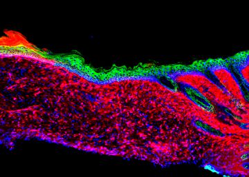 Los científicos logran por primera vez regenerar ‘in vivo’ la piel de un mamífero