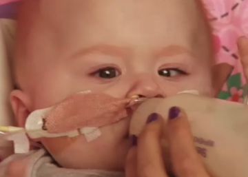 La niña que nació con el corazón fuera del cuerpo