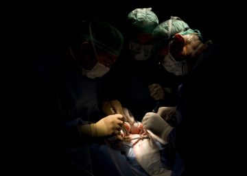 El extraño caso de la mujer que donó sus órganos y transmitió el cáncer a cuatro personas