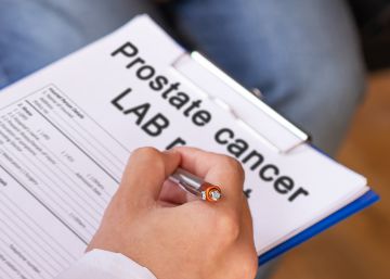 What young men need to know about prostate cancer