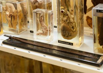 El extraño muestrario de cuerpos enfermos