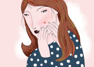 Los seis tipos de granos que distinguen los dermatólogos y cómo tratarlos