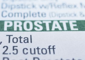 The busy life of the prostate gland