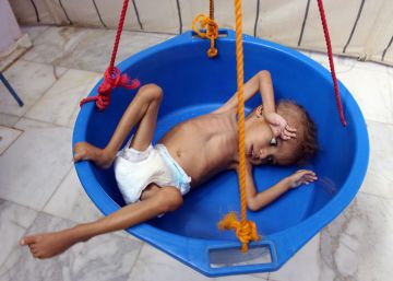 El hambre acecha a la infancia en Yemen