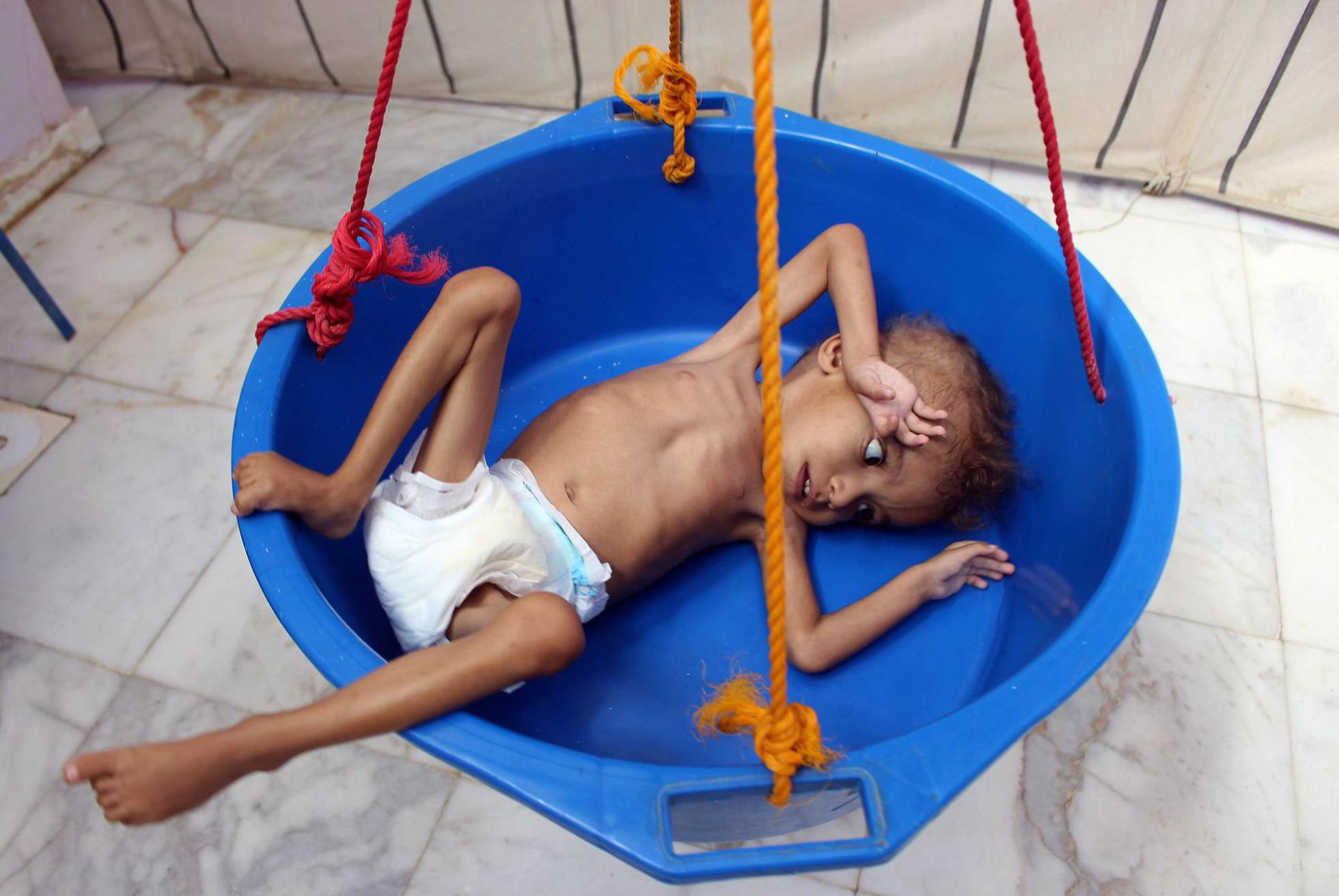 El hambre acecha a la infancia en Yemen