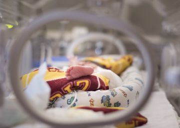 Las 12 mejoras imprescindibles y urgentes para cuidar al bebé prematuro