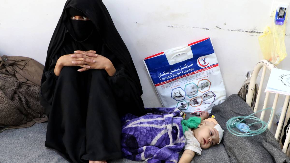 Una madre yemení, junto a su hijo desnutrido, en Saná.