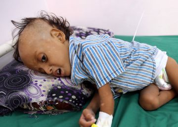 Matanza en Yemen