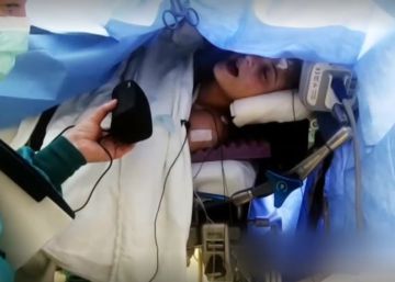 Una joven canta mientras le operan de un tumor cerebral