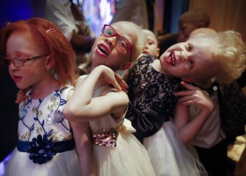 Quênia realiza concurso para eleger a Miss e o Mister Albino