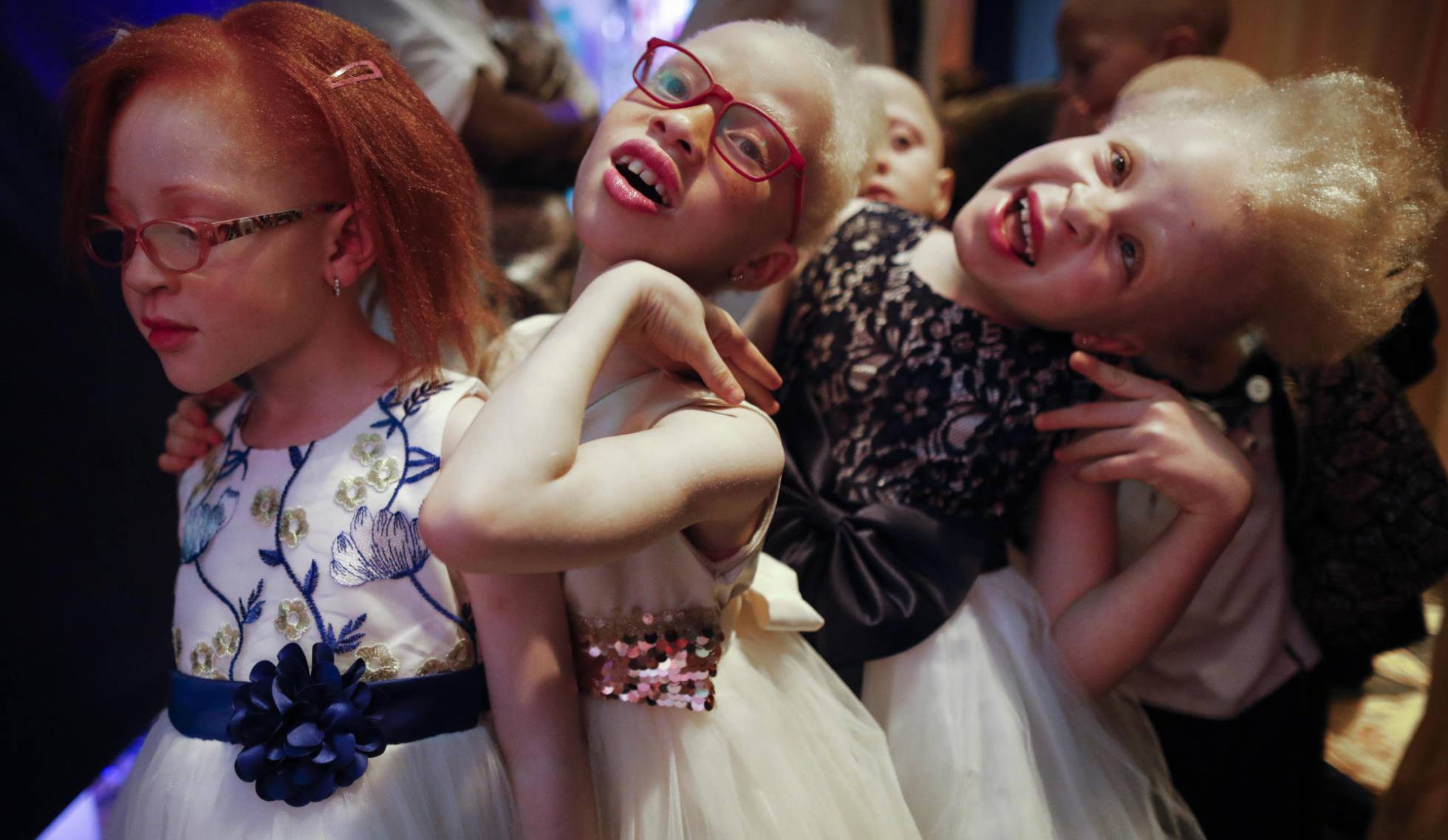 Quênia realiza concurso para eleger a Miss e o Mister Albino