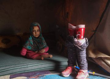 La niña siria que usaba latas de atún como piernas ya tiene prótesis