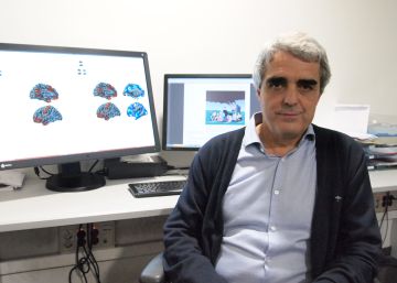 Así es el cerebro de un psicópata