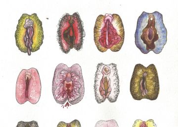 Anatomia de uma intimidade confusa: quando uma vagina normal se transforma num complexo