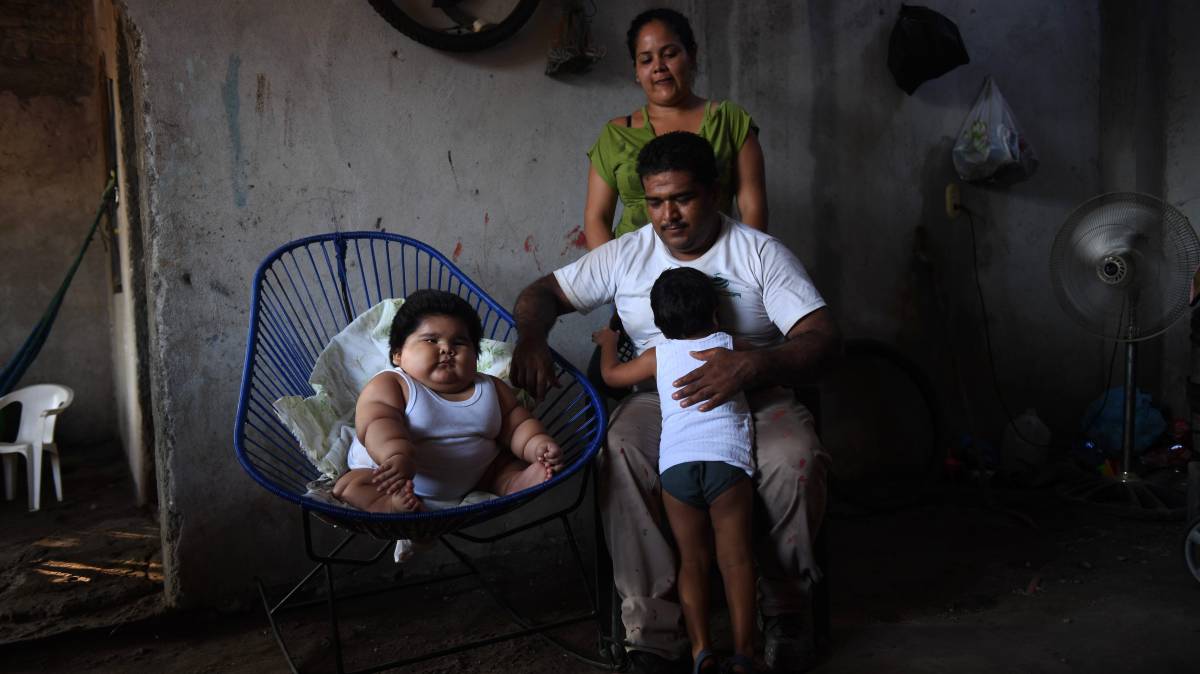 Luis Gonzales, edad 10 meses, peso 28 kilos. (México)