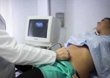 Mejor vigilar los quistes ováricos benignos que extirparlos