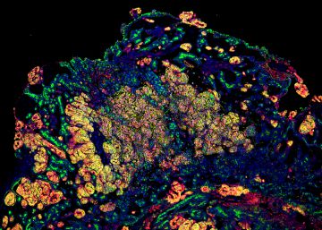 La medicina regenerativa es perfecciona amb ‘minironyons’ humans vascularitzats