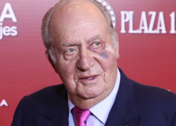 ¿Por qué tiene un ojo morado el rey Juan Carlos?