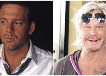 La última operación de Mickey Rourke revoluciona las redes