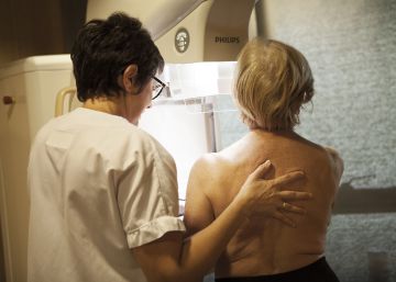 Las terapias hormonales para la menopausia están asociadas a un mayor riesgo de cáncer de mama