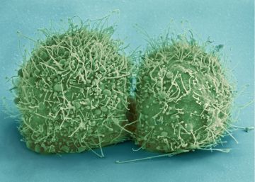 Un cuarto de éxito contra el cáncer