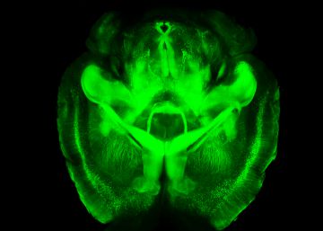 Viaje al fondo de un cerebro que no duerme
