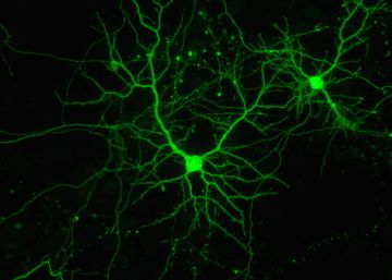Una nueva tecnología pretende monitorizar las neuronas de manera simultánea y en tiempo real