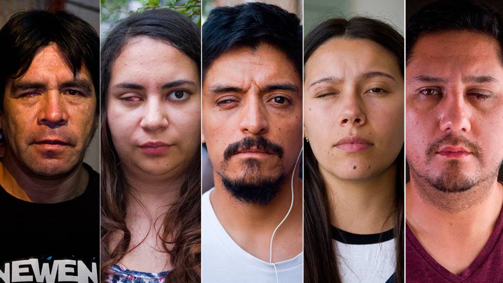 Las víctimas de la violencia policial en Chile