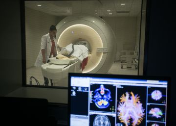 La mala qualitat del son desperta l’alzheimer