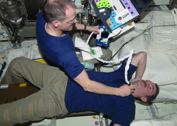 Un coágulo en la yugular de un astronauta obliga a la NASA a improvisar una cura en órbita