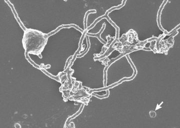 Encontrado o organismo que explica a origem de toda a vida complexa da Terra