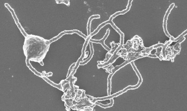 Imagen de microscopio de una arquea de Asgard con sus tentáculos a la derecha.