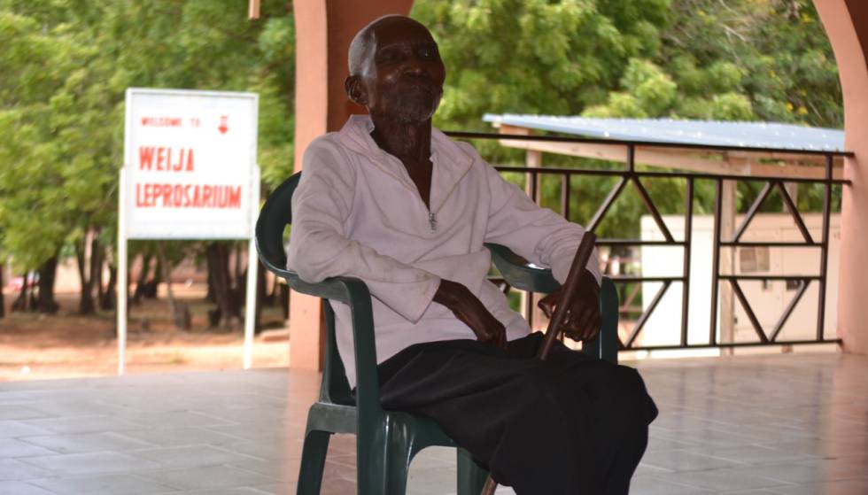 Koju Aggrey, hoy un anciano de 90 años, en el centro para personas que han padecido lepra en la localidad de Weija, muy cerca de Accra, capital de Ghana. rn rn