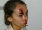 Karla Janeth Silva, después de la golpeadura por sicarios