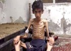 L’assetjada ciutat siriana de Madaya es mor de gana
