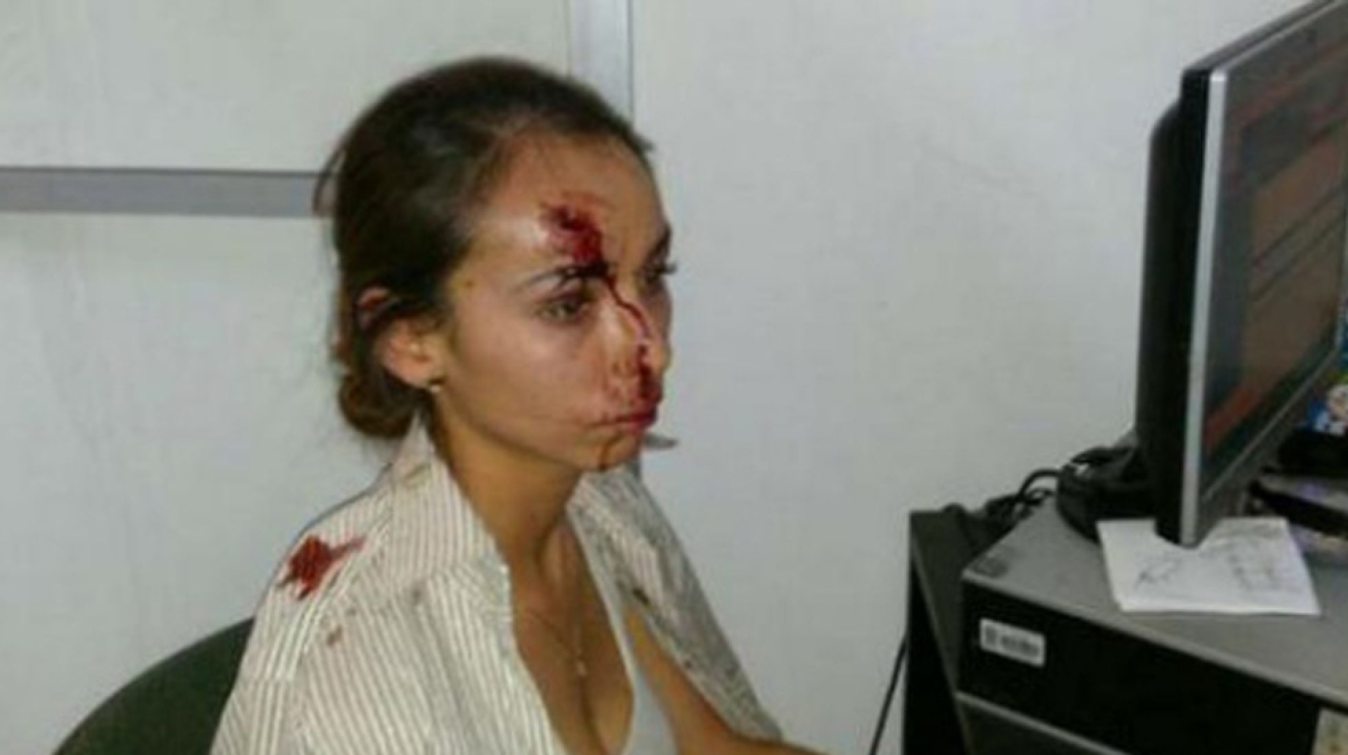 La periodista Karla Silva tras la agresión de 2014. La periodista Karla Silva tras la agresión de 2014.