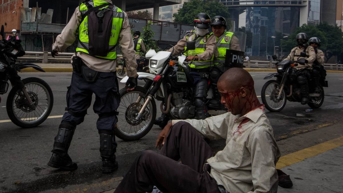 Un hombre herido junto a miembros de la Guardia Nacional Bolivariana.