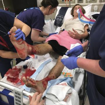 El adolescente Sam Kanizay recibe asistencia médica.