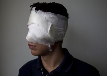 Manifestantes contrários a Maduro detalham torturas e abusos praticados pelo Governo venezuelano Manifestantes contrários a Maduro detalham torturas e abusos praticados pelo Governo venezuelano