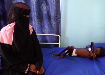 Los dos bandos de la guerra en Yemen hablan de sus expectativas para la paz