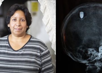 Una bala perdida en el cerebro de Lourdes, un sinfín de armas en Iztapalapa