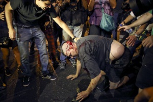 Un manifestante herido tras las cargas. Un manifestante herido tras las cargas.
