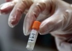 España tiene dos millones de vacunas de viruela caducadas