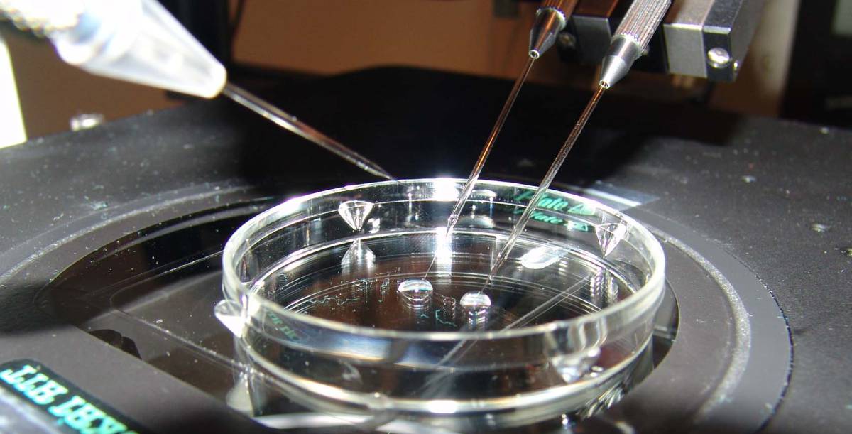 Proceso de fecundación in vitro.